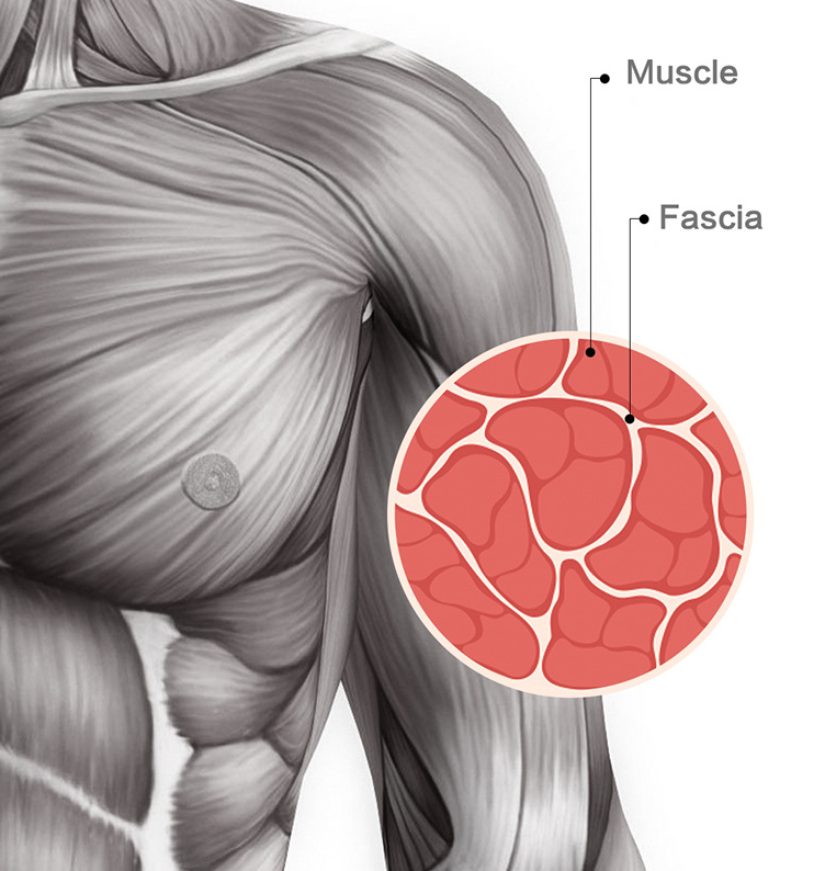 Pistola de masaje para gimnasio